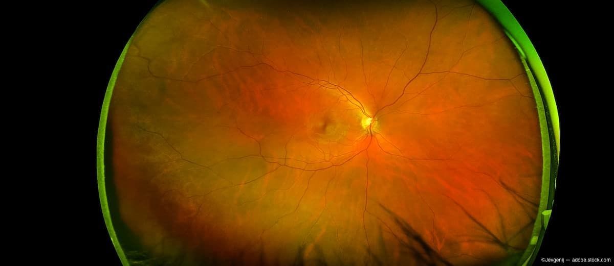 Image of retina Image Credit: AdobeStock/Jevgenij