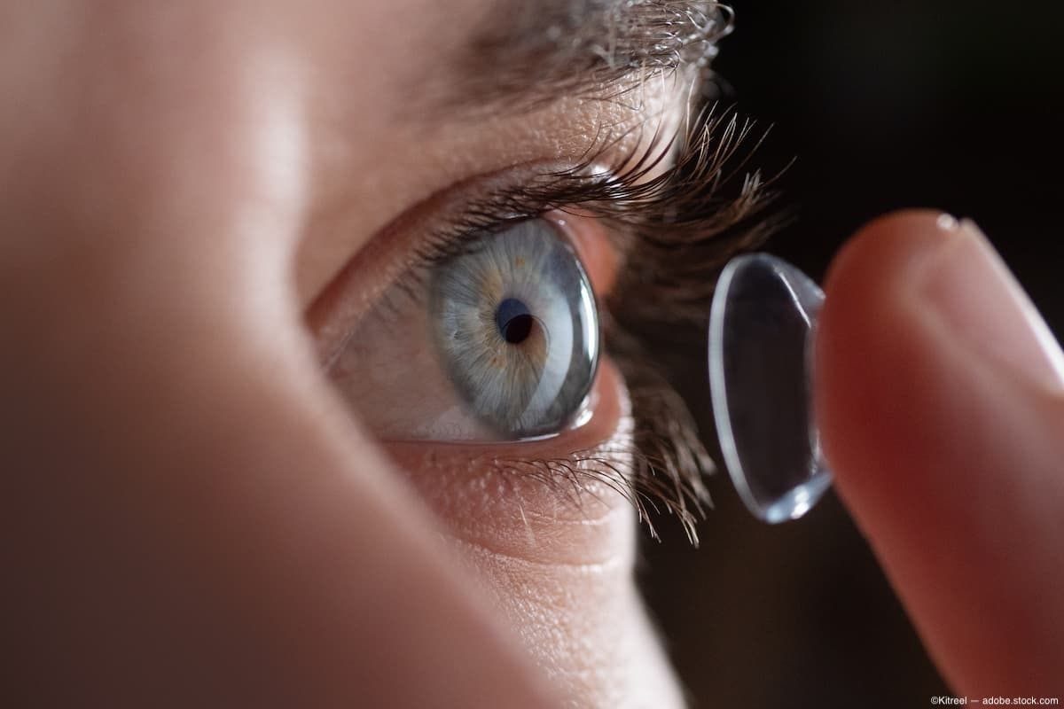 Close-up of a person inserting a contact lens into an eye Image Credit: AdobeStock/Kitreel