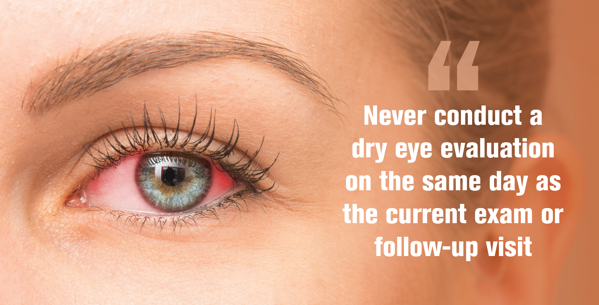 3 steps to getting started with dry eye treatment
