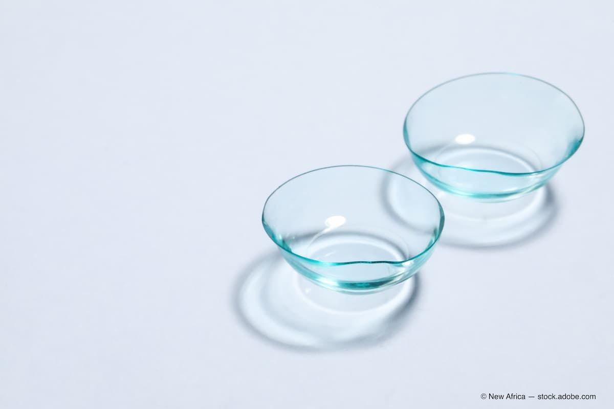 Pair of contact lenses on white background, space for text (Adobe Stock / New Africa)