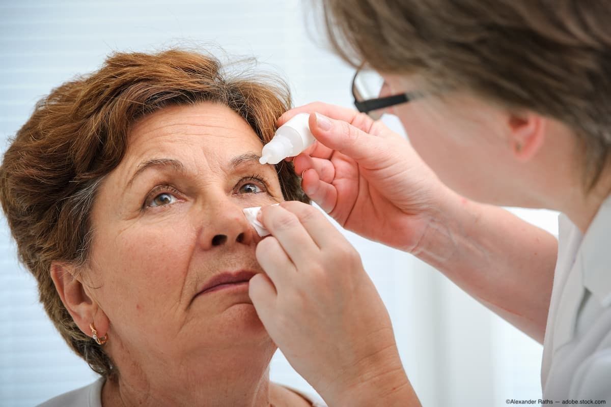 Patient having eye drops administered by physician Image Credit: AdobeStock/AlexanderRaths