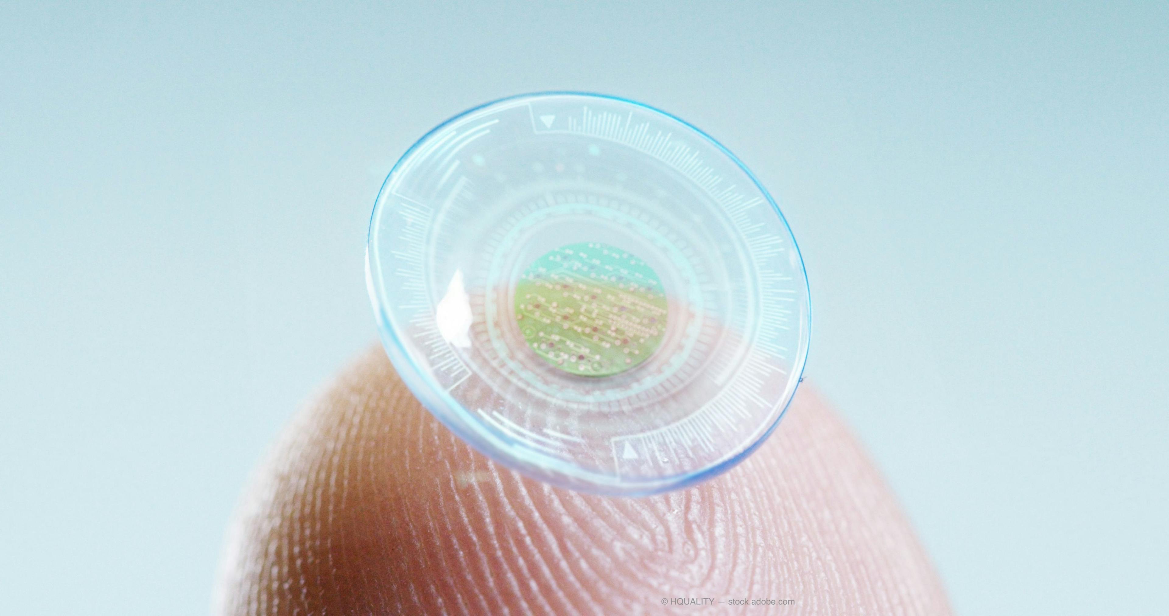 Researchers are investigating a 3D-printed self-moisturizing contact lens that could be a catalyst for the development of next-generation contact lens-based medical devices.