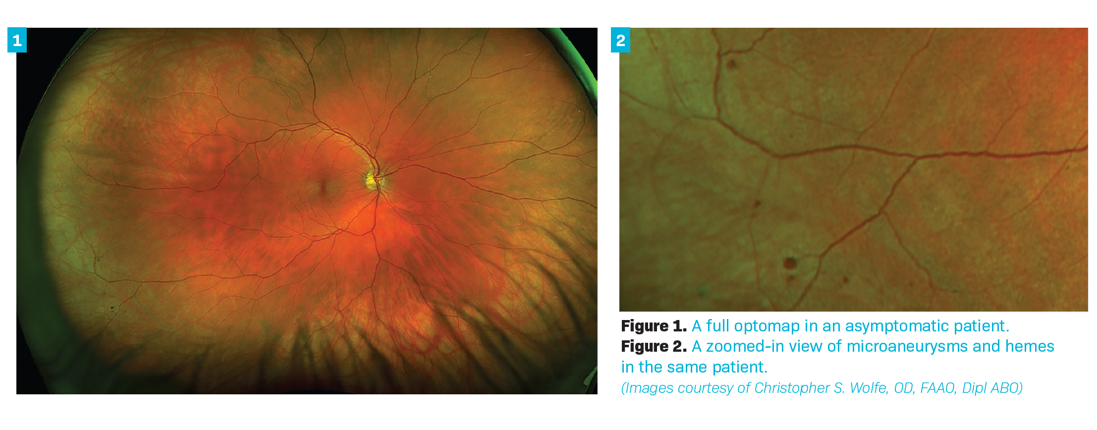 Visualizing periphery is part of a comprehensive eye exam