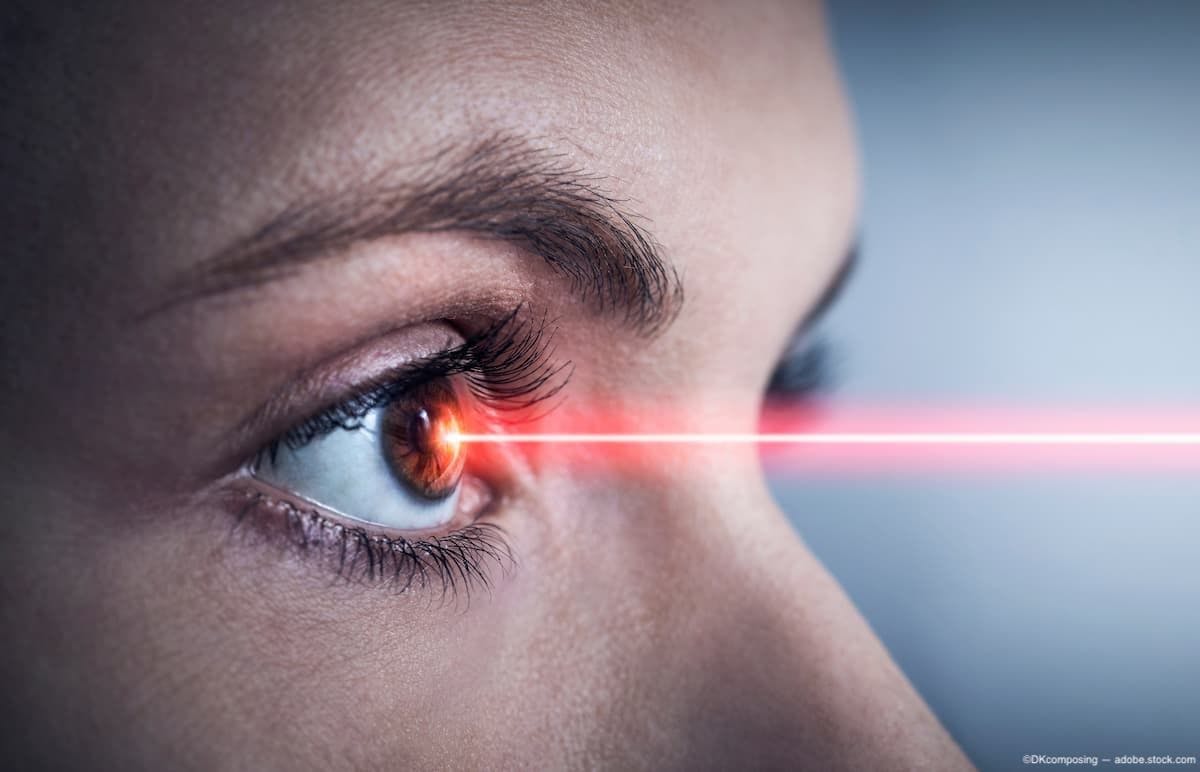Red laser in eye Image credit: ©DKcomposing - adobe.stock.com