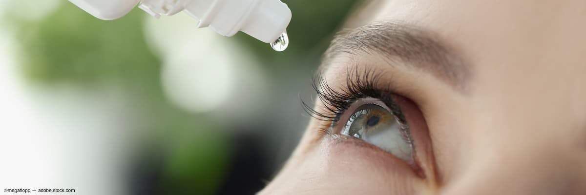 Close-up of administering eye drop into eye Image Credit: AdobeStock/megaflopp
