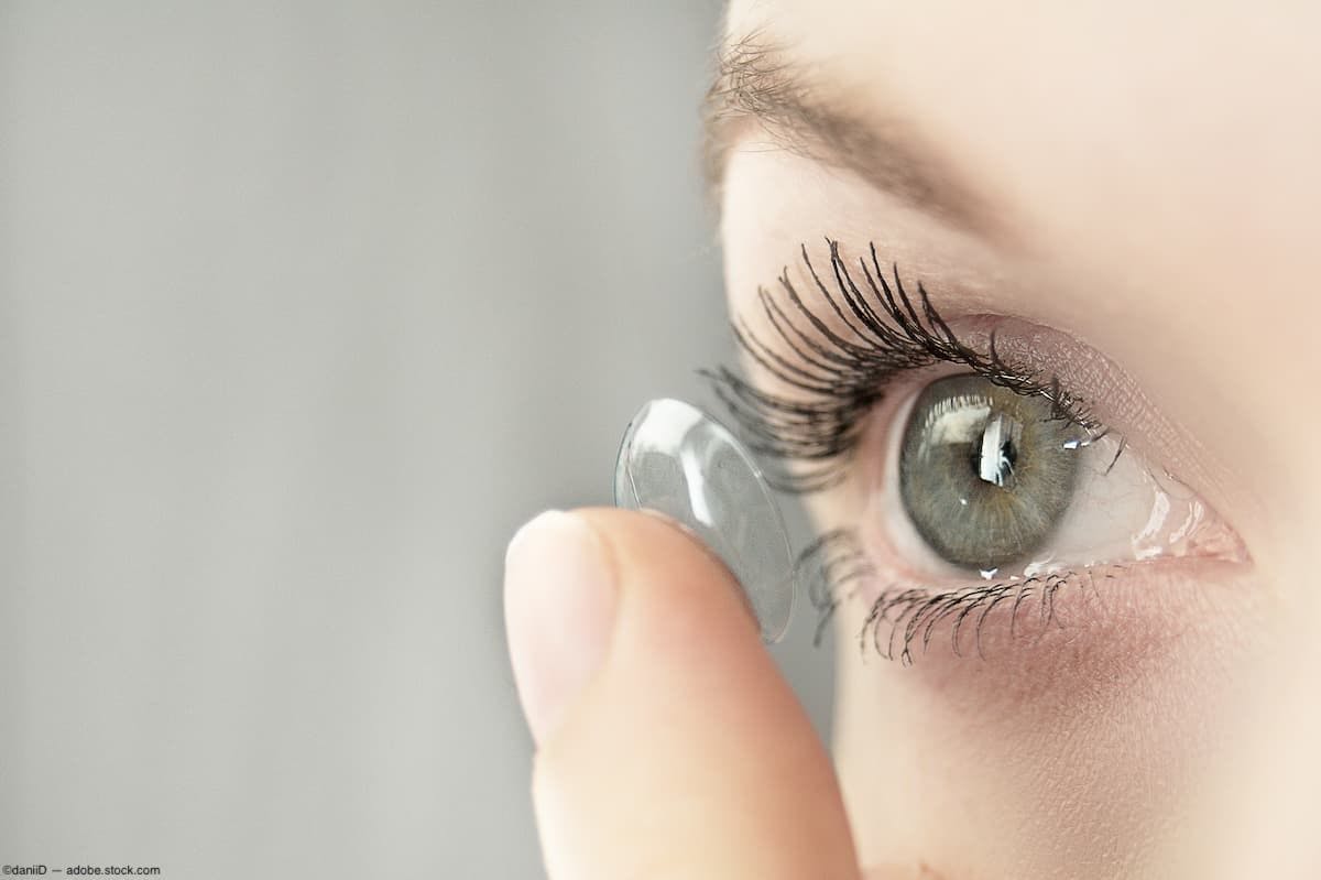 Closeup of contact lens being inserted Image credit: ©daniiD - adobe.stock.com