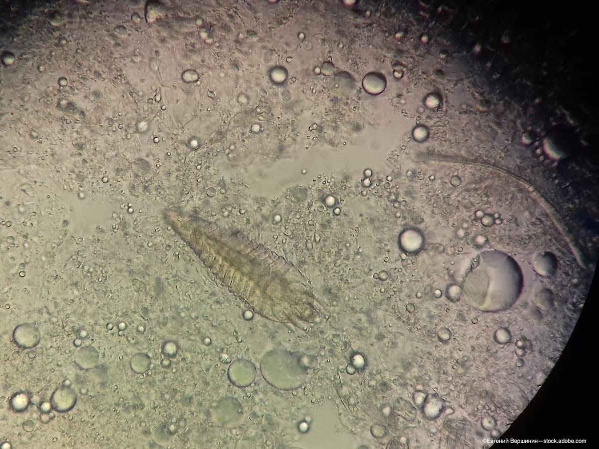 Demodex mite under microscope (Adobe Stock / Евгений Вершинин)