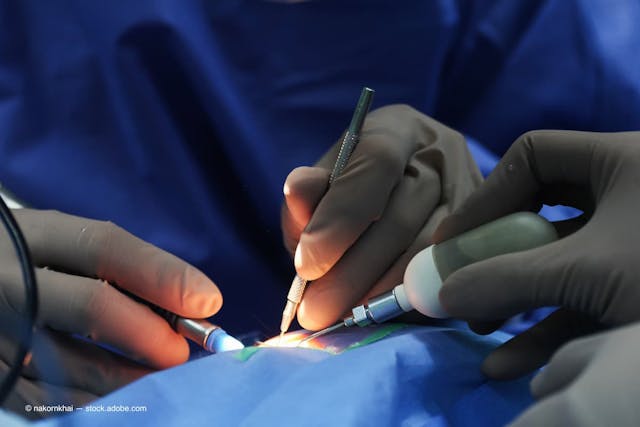 Size plays role in injection of IOLs during cataract surgery