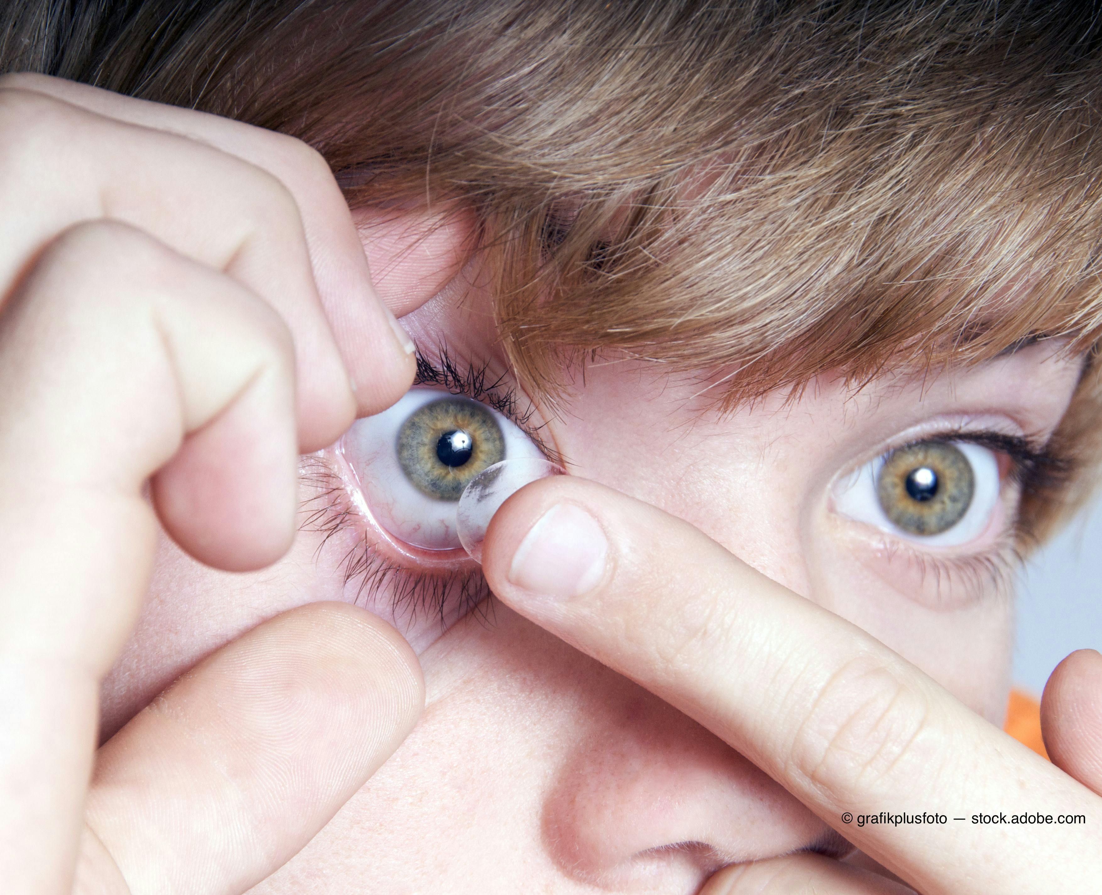4 tips to help staff identify contact lens candidates