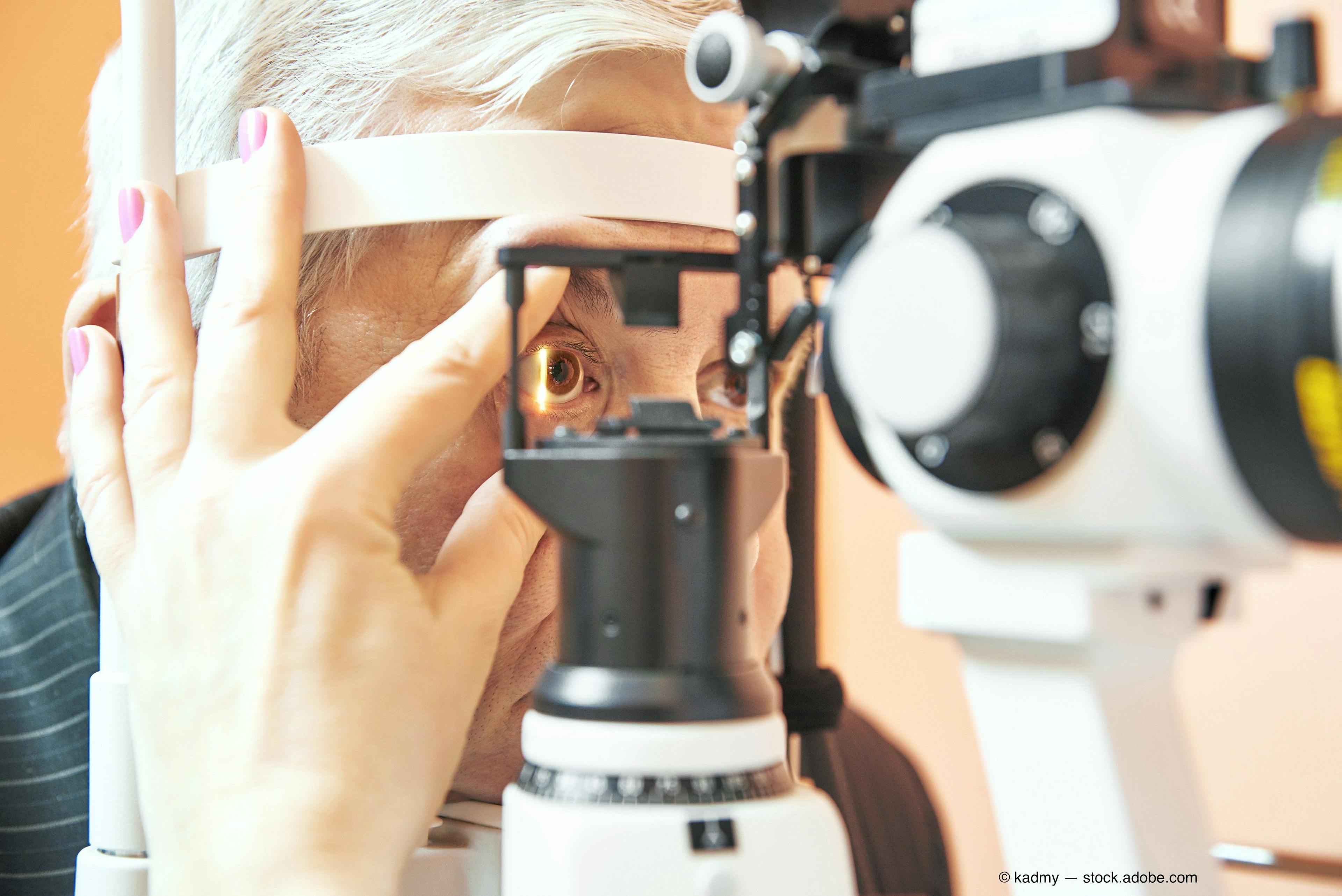  Consider IOP fluctuations when diagnosing glaucoma
