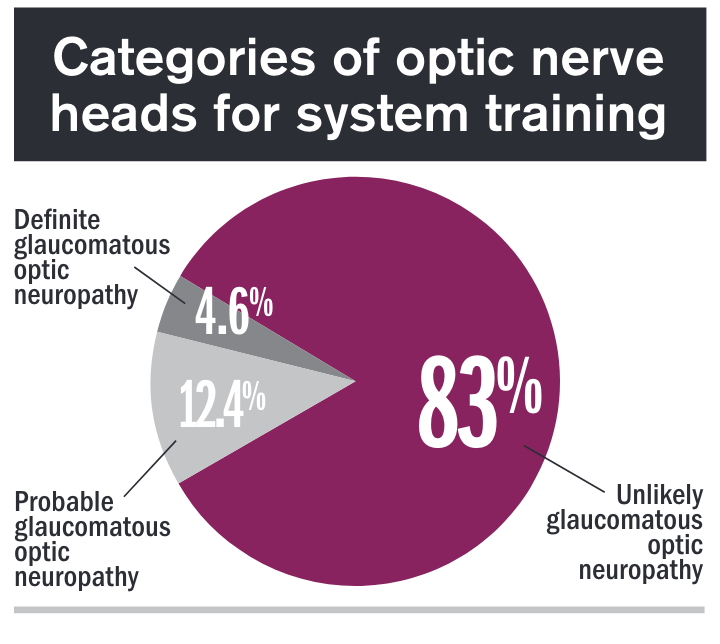 New research highlights how data is processed to detect glaucomatous optic neuropathy