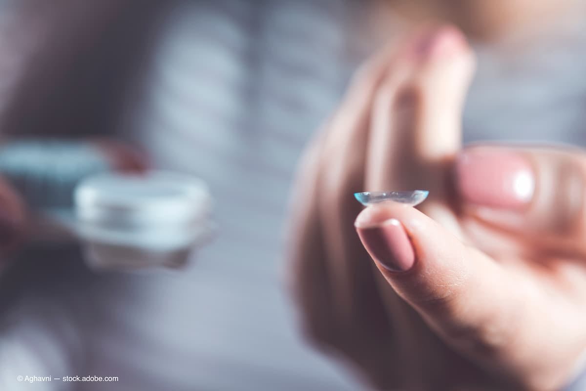 Elevating your contact lens practice brings numerous benefits 