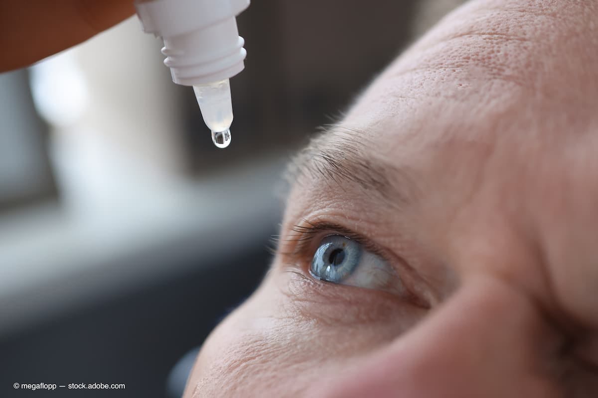 Man drips eye drops into eyes closeup (Adobe Stock / megaflopp)