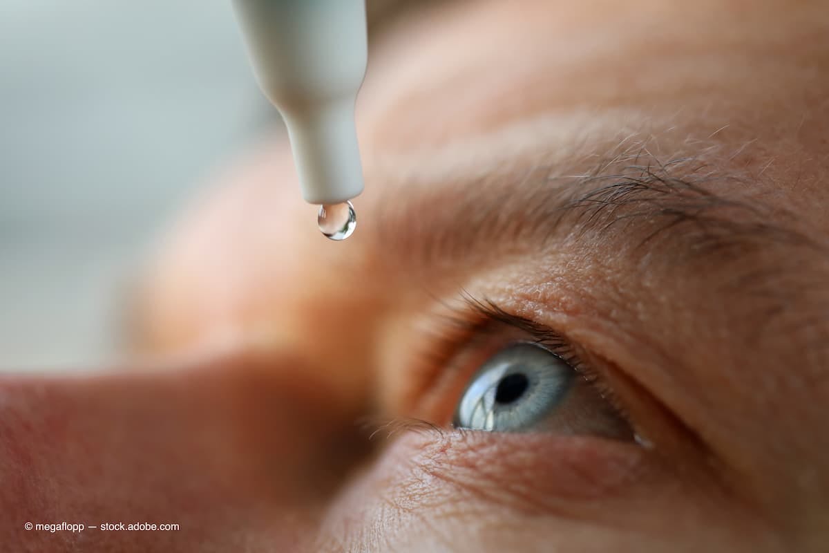 Man drops eye drops install lenses, moisturizing  (Adobe Stock / megaflopp)