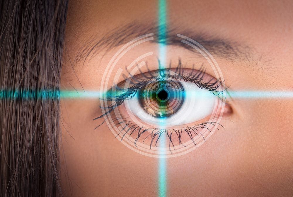 Topography-guided LASIK provides personalized vision