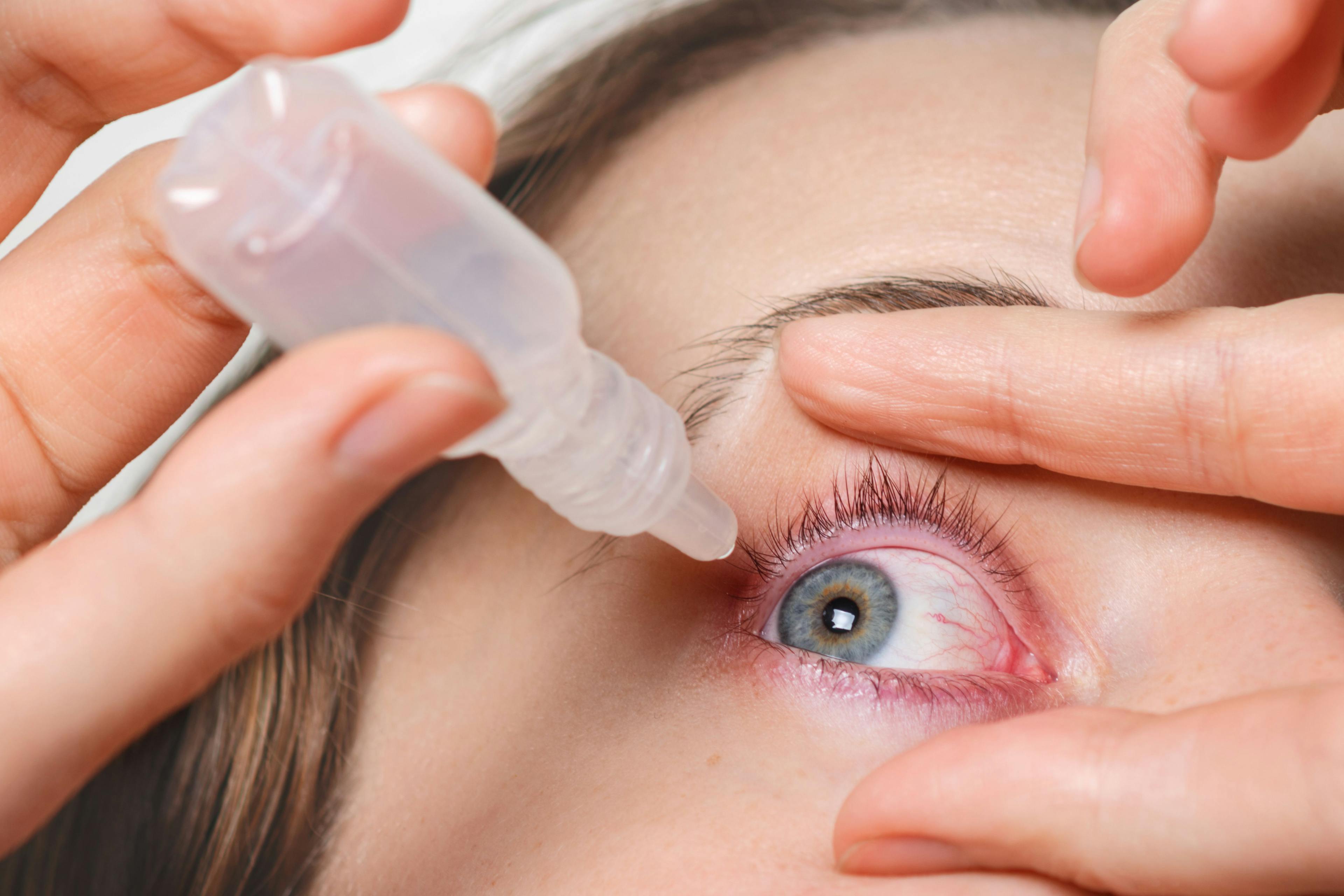 Glaucoma drugs and drug delivery: Arising from the pandemic