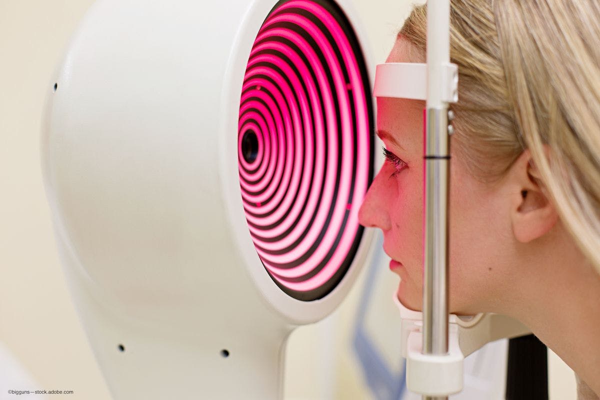 woman is screened by optometrist for keratoconus - Image credit: Adobe Stock / bigguns