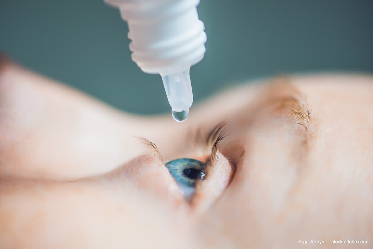 Closeup of eyedropper putting liquid into open eye (Adobe Stock / galitskaya)