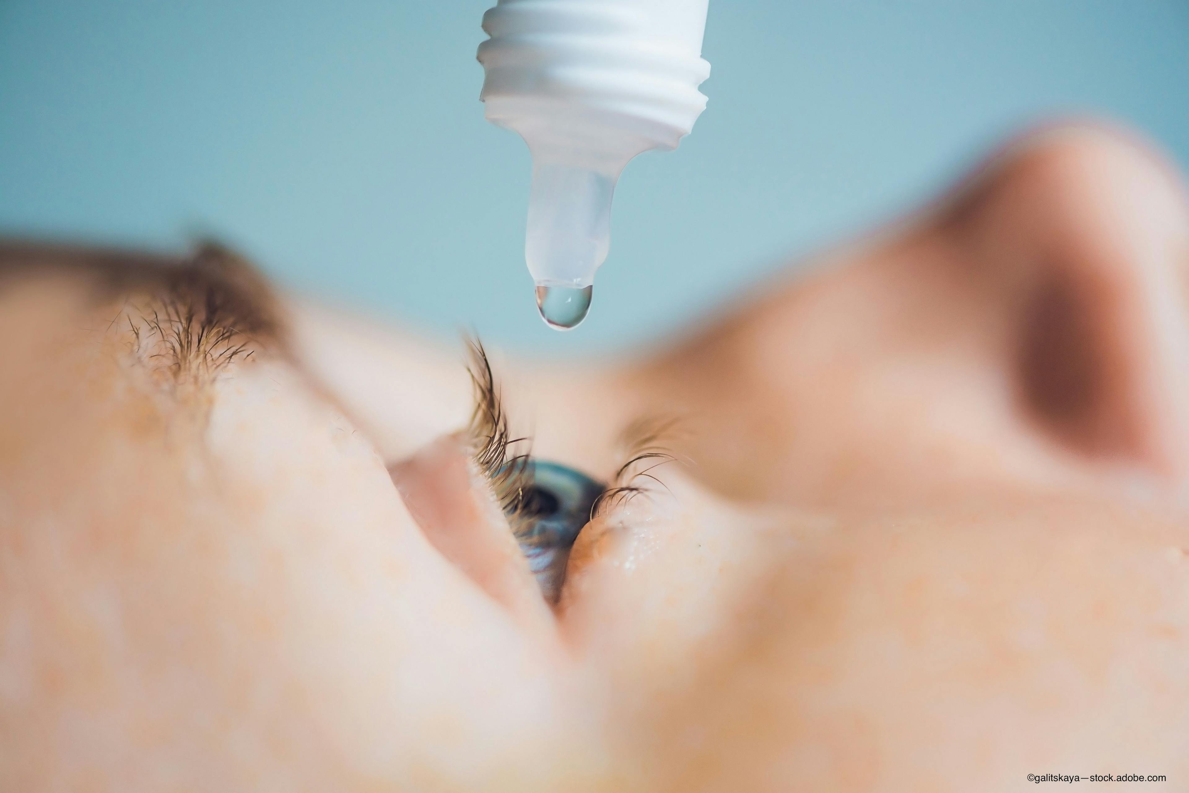 Nyxol eye drop being used in blue eye
