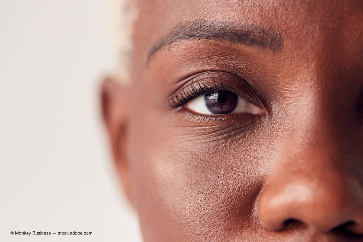 Close Up On Eyes Of Young Woman With Dyed Hair In Studio (Adobe Stock / Monkey Business)