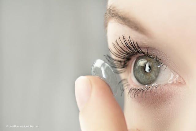girl wearing soft contact lenses close-up macro (Adobe Stock / daniiD)