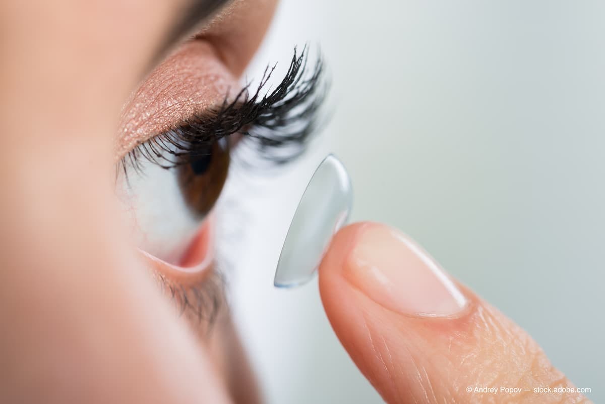 Woman putting a contact lens into her eye (Adobe Stock / Andrey Popov)