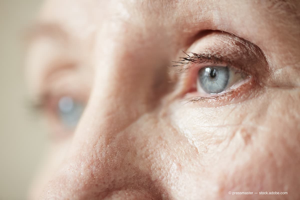 Close up of white elderly woman's blue eye (Adobe Stock / pressmaster)
