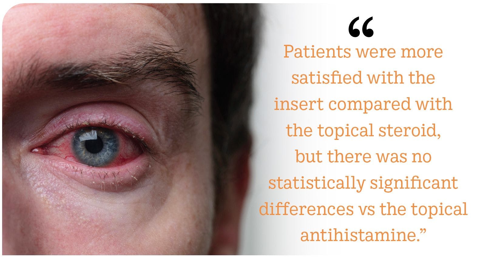 Patients were more satisfied with the insert compared with the topical steroid, but there was no statistically significant differences vs the topical antihistamine.
