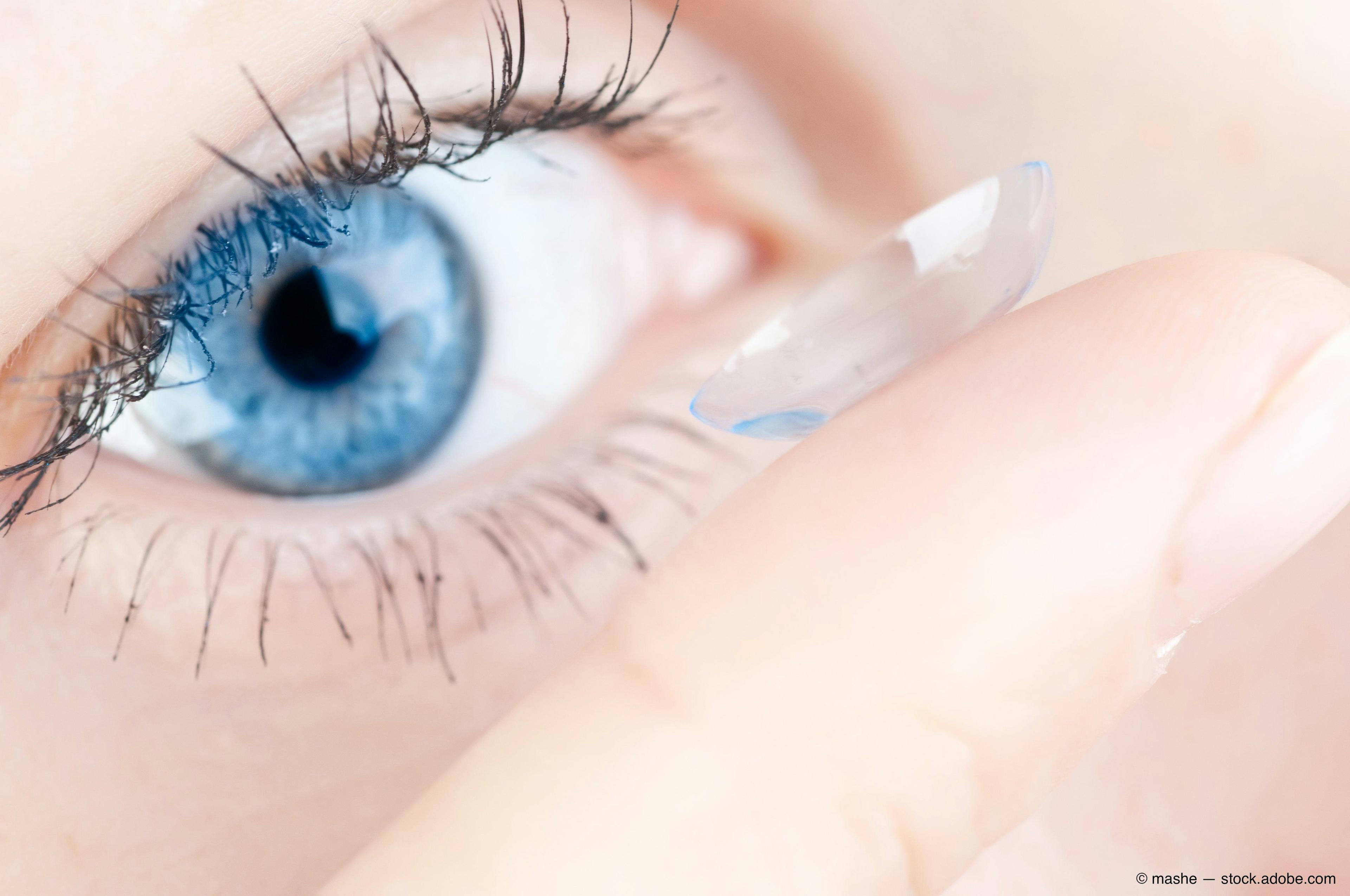 contact lens on finger in front of blue eye