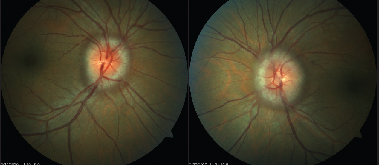 Expecting the unexpected in ocular cases
