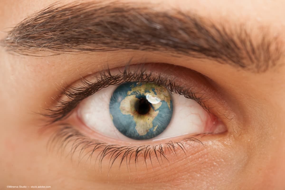 World Sight Day 2023: HCP Cureblindness spotlights avoidable blindness