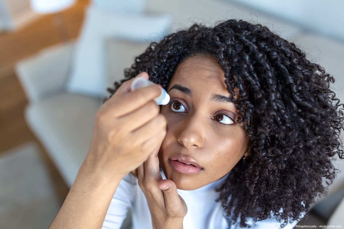 woman uses FDA-approved MIEBO to treat signs and symptoms of dry eye disease - Image credit: Adobe Stock/©Graphicroyalty