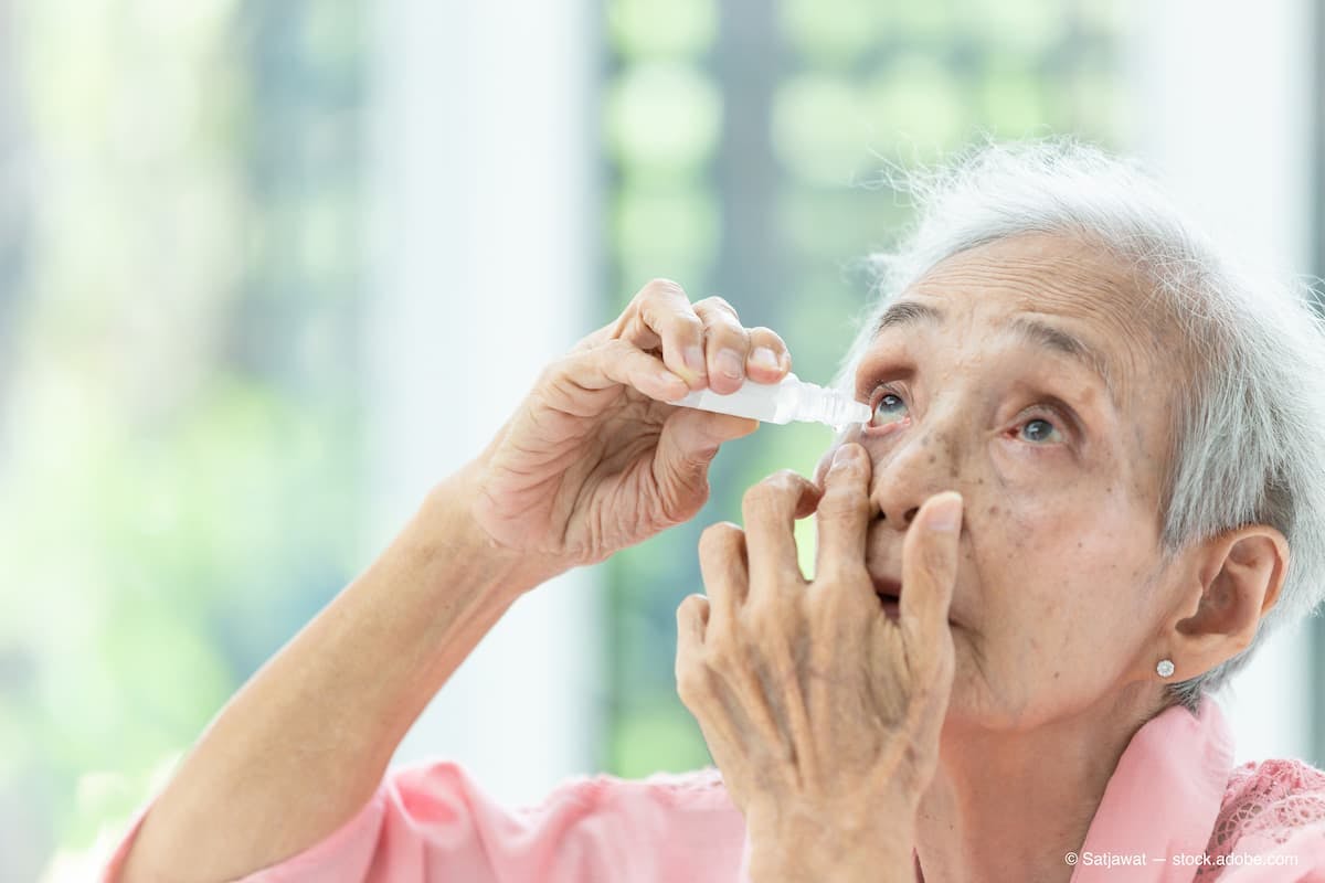 Asian senior woman putting eye drop, closeup view of elderly person using bottle of eyedrops in her eyes, sick old woman suffering from irritated eye, optical symptoms, health concept (Adobe Stock / Satjawat)