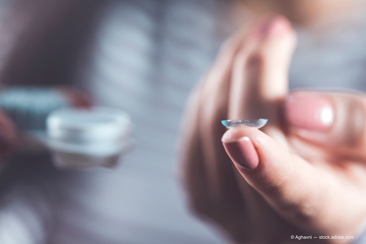 Woman holding contact lens (Adobe Stock / Aghavni)