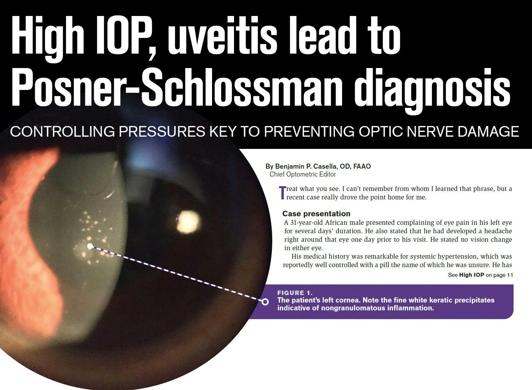 High IOP, uveitis lead to Posner-Schlossman diagnosis