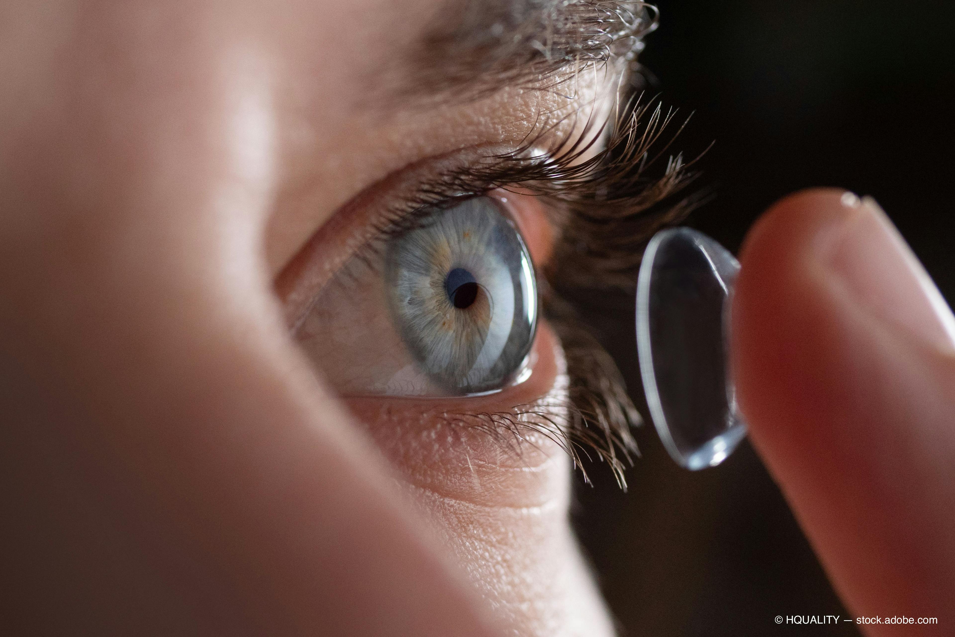 Modernize contact lens wear in 2019