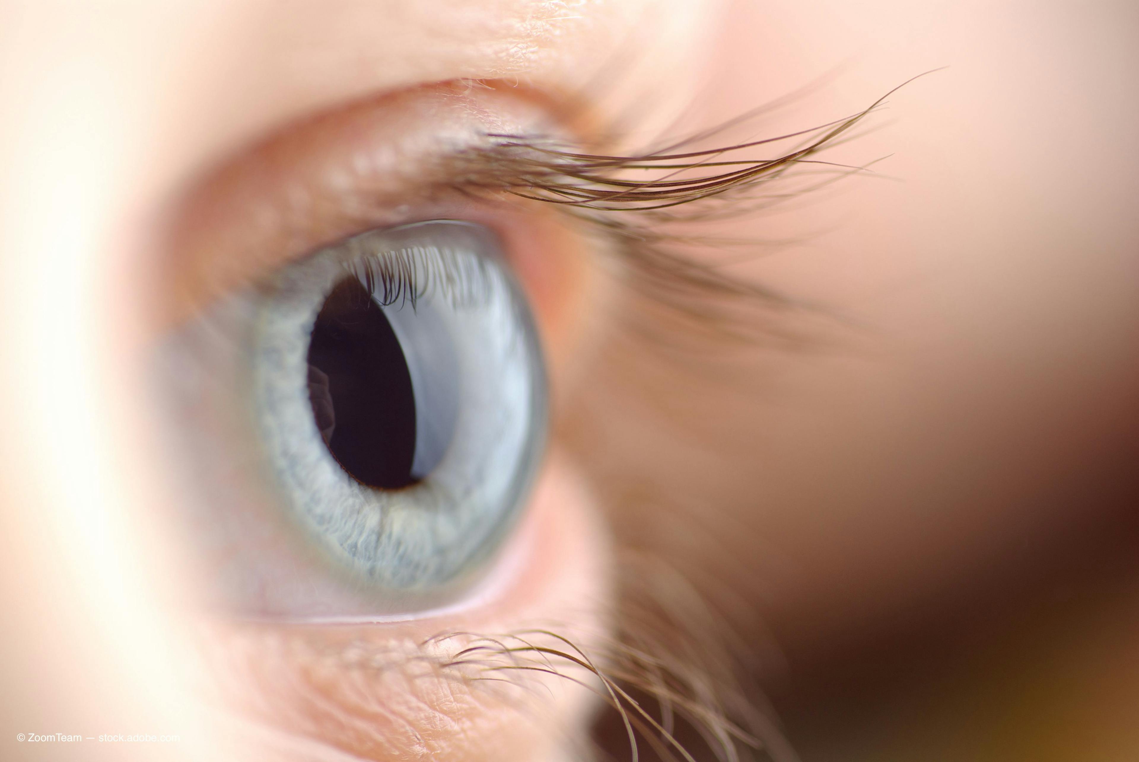 Glaukos launches phase 2 corneal health clinical program for iLink therapy