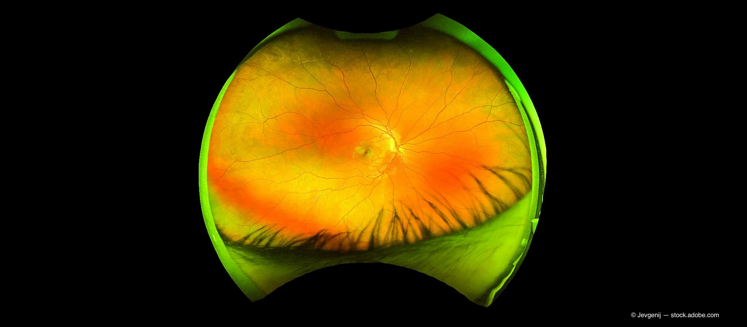 Predicting glaucoma progression: More than meets the eye
