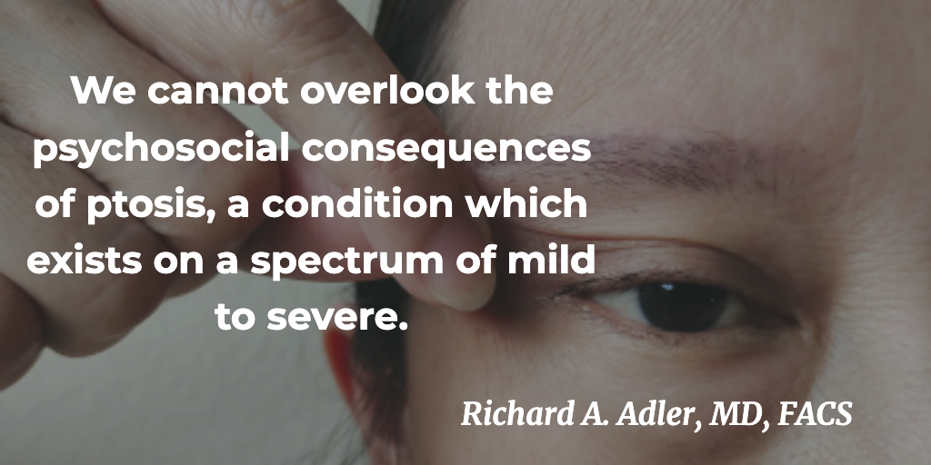 We cannot overlook the psychosocial consequences of ptosis, a condition which exists on a spectrum of mild to severe.