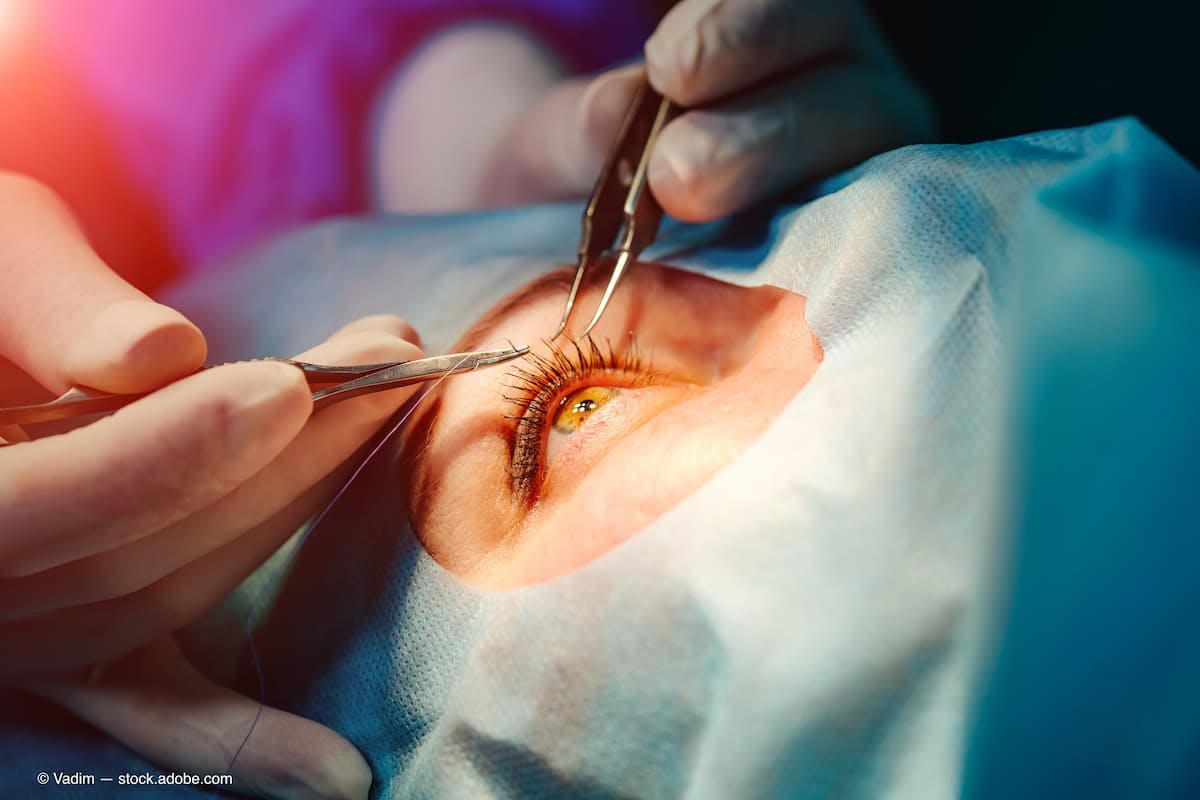 Preoperative visual decrease possible after phacoemulsification surgery
