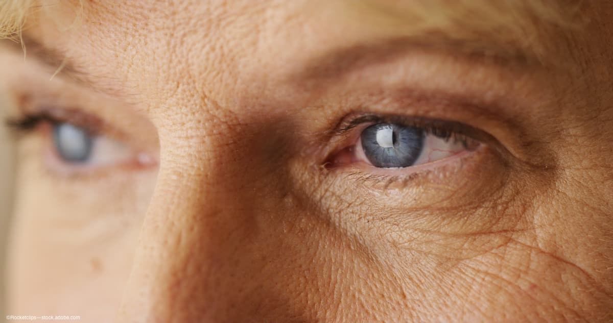 Close up of elderly persons eyes