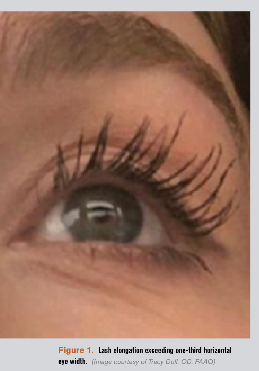 Know the ocular effects of eyelash growth serums