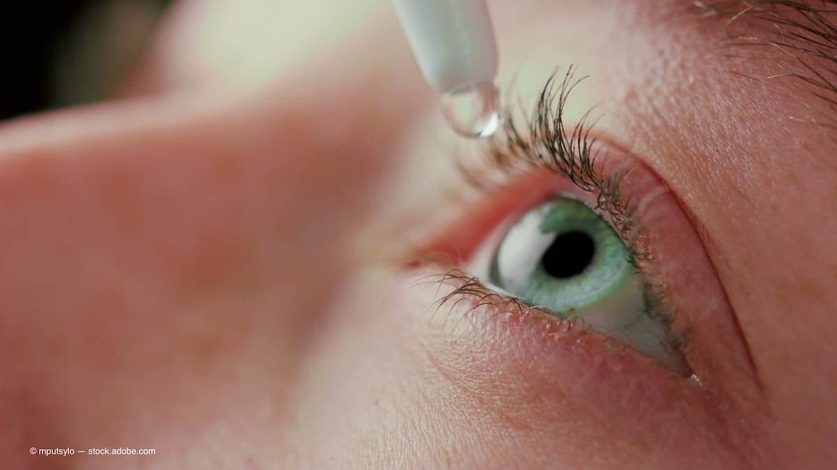 macro close up eye using eyedrops liquid medicine healthy eyesight clarity concept (Adobe Stock / mputsylo)