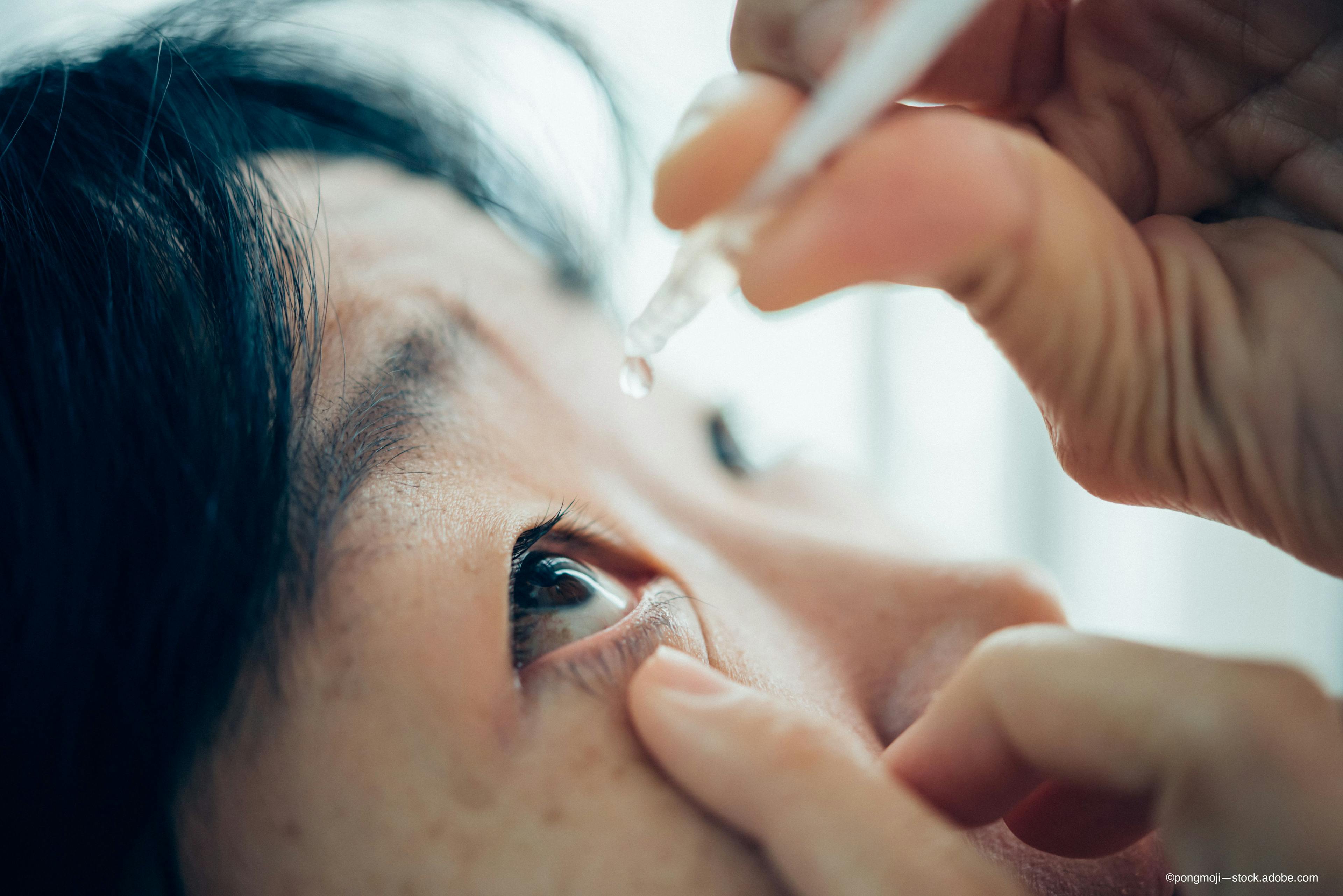 eye drops are now subject to revised draft guidance for ophthalmic drugs - Image credit: Adobe Stock / ©pongmoji