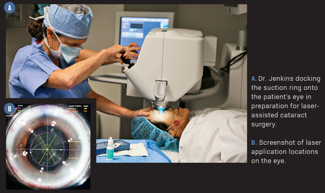 Comparing laser-assisted vs. conventional refractive cataract surgery