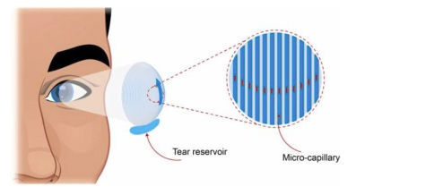 A graphical abstract of the self-moisutrizing conact lens. 