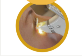 Systane iLux2 Meibomian Gland Dysfunction (MGD) Thermal Pulsation System 