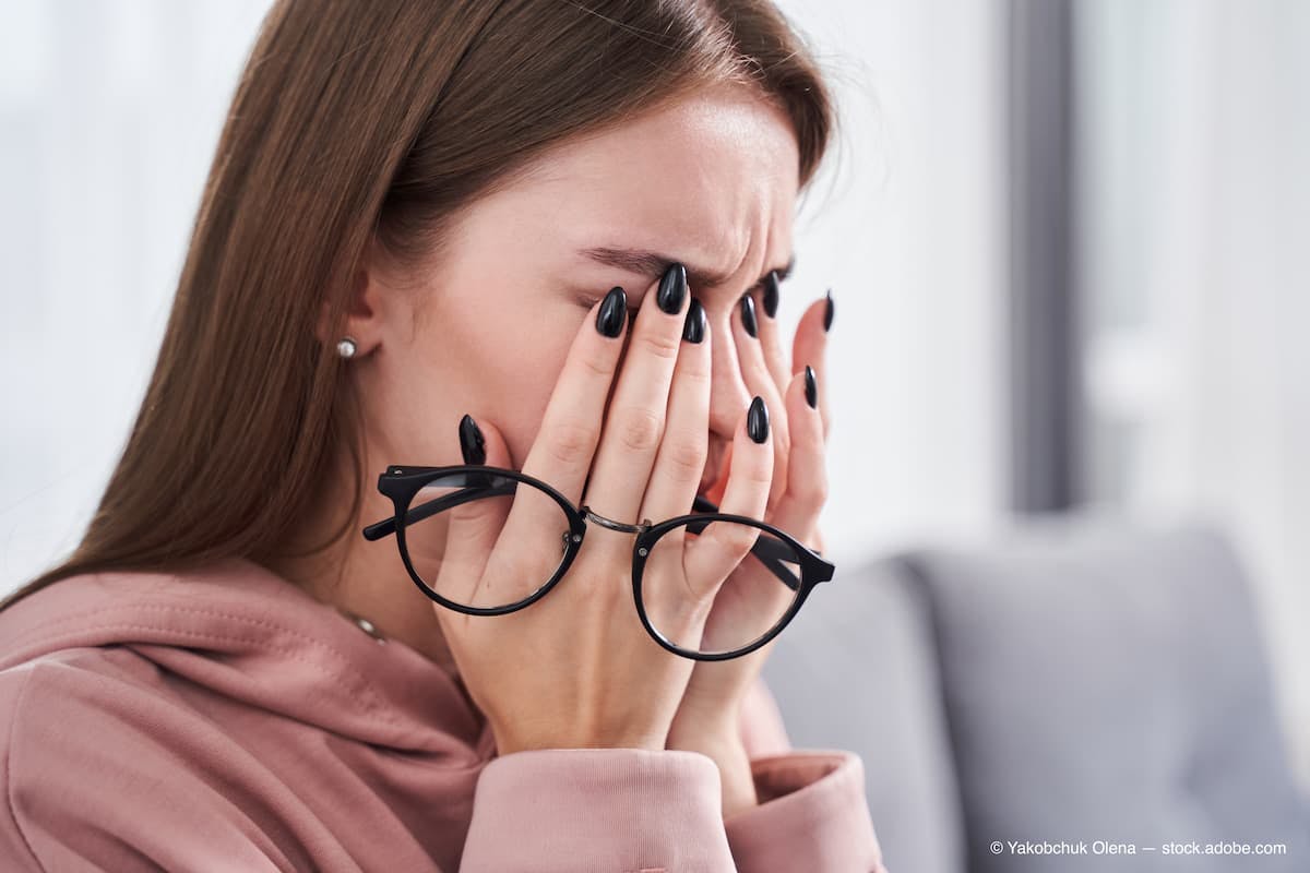 Woman rubbing dry irritated eyes (Adobe Stock / Yakobchuk Olena)