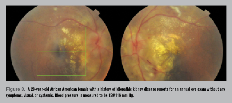 Retina scan images