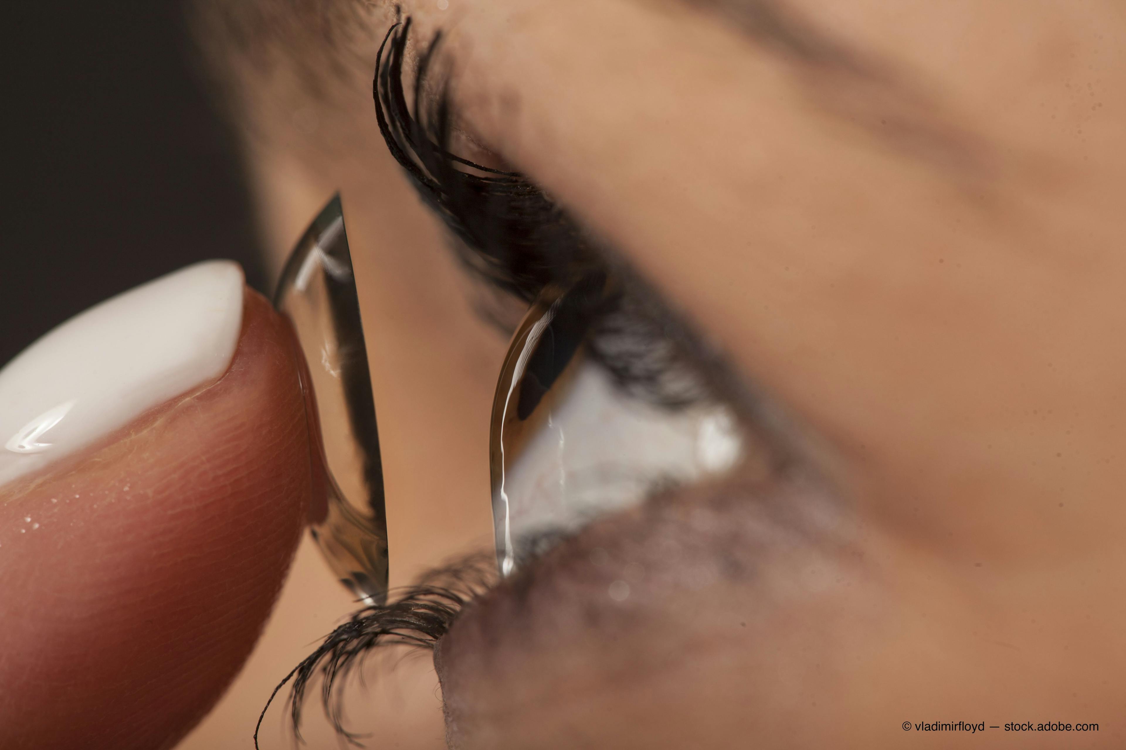 Five ways to stand out with specialty contact lenses